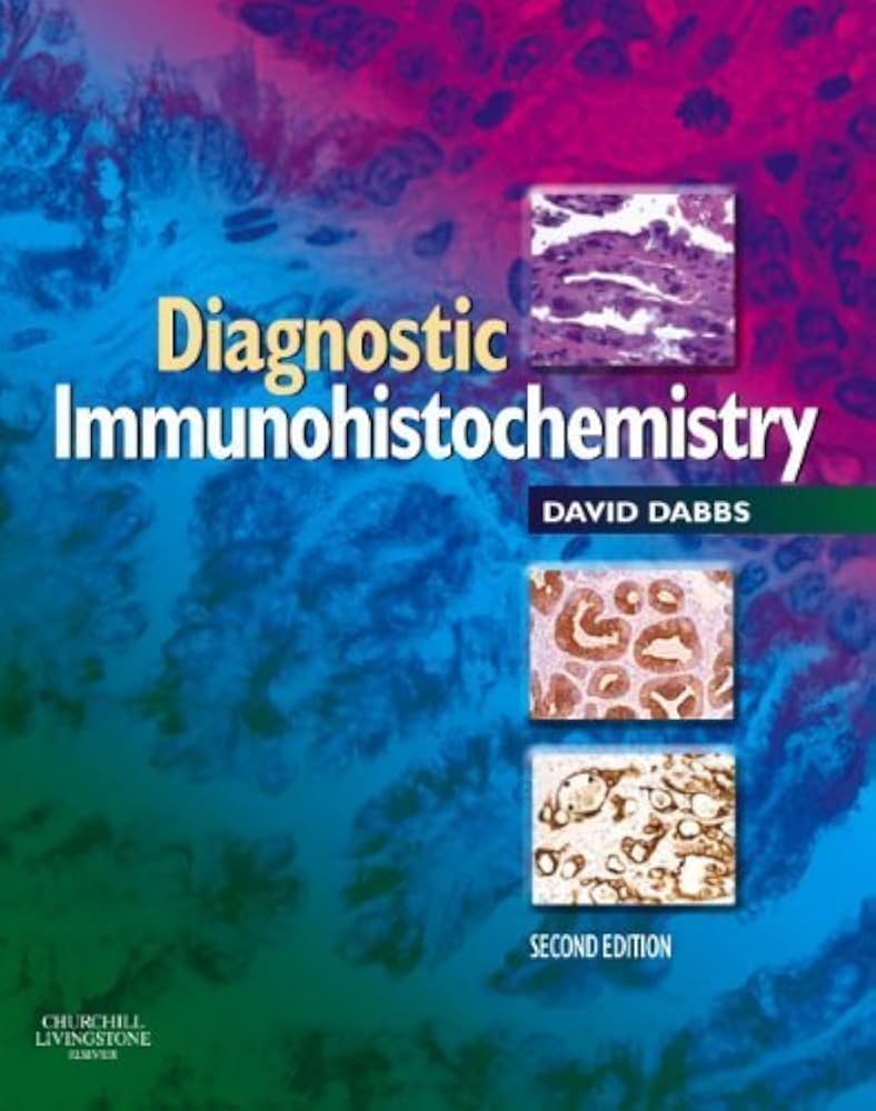Amazon | Diagnostic Immunohistochemistry: Theranostic and Genomic